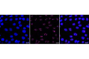 anti-Actin-Like 6A (BAF53A) antibody