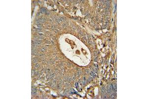 Paraformaldehyde-fixed, paraffin embedded human colon tissue, Antigen retrieval by boiling in sodium citrate buffer (pH6. (ACOX1 抗体)