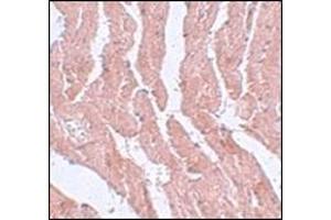 Immunohistochemistry of LZTR1 in mouse heart tissue with this product at 5 μg/ml. (LZTR1 抗体  (N-Term))