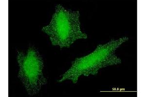 Immunofluorescence of monoclonal antibody to VHL on HeLa cell. (VHL 抗体  (AA 1-110))