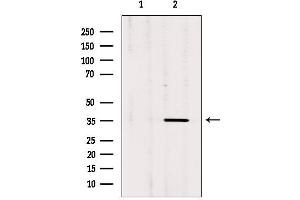 Western blot analysis of extracts from rat brain, using OR3A1 Antibody.