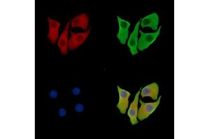 LZTS3 Antibody staining Hela cells by IF/ICC. (ProSAPiP1 抗体)