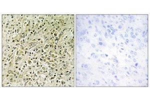 Immunohistochemistry (IHC) image for anti-Deleted in Liver Cancer 1 (DLC1) (N-Term) antibody (ABIN1849916) (DLC1 抗体  (N-Term))