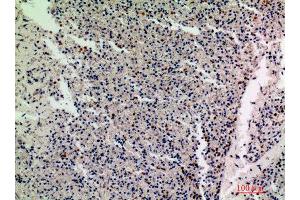 Immunohistochemistry (IHC) analysis of paraffin-embedded Human Spleen, antibody was diluted at 1:200. (IL1F10 抗体)