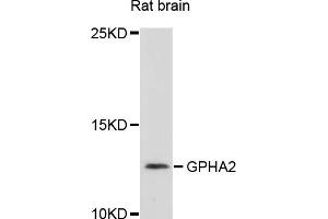 Western blot analysis of extracts of rat brain, using GPHA2 antibody (ABIN4903807) at 1:1000 dilution. (GPHa2 抗体)