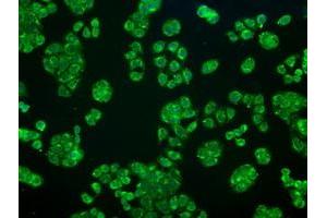 Image no. 5 for anti-Crystallin, alpha B (CRYAB) antibody (ABIN1497644) (CRYAB 抗体)