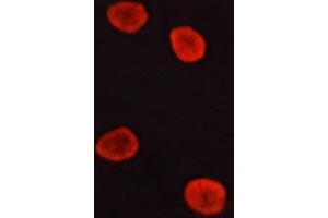 ABIN6266535 staining lovo cells by ICC/IF. (ERK1/2 抗体)