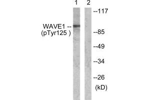Western Blotting (WB) image for anti-WAS Protein Family, Member 1 (WASF1) (pTyr125) antibody (ABIN1847304) (WASF1 抗体  (pTyr125))