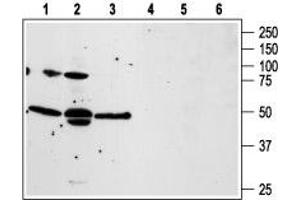 Western blot analysis of human prostate carcinoma PC3 (lanes 1 and 4), and LNCaP (lanes 2 and 5), and human T cell leukemia Jurkat (lanes 3 and 6) cell lines: - 1-3. (F2RL3 抗体  (1st Extracellular Loop))