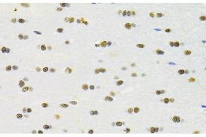 Immunohistochemistry of paraffin-embedded Rat brain using RBPJ Polyclonal Antibody at dilution of 1:100 (40x lens). (RBPJ 抗体)