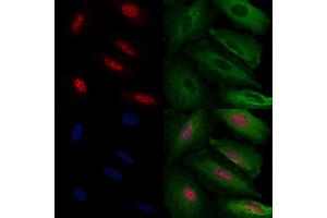 ABIN6263185 and ABIN6272471 staining  cells by IF/ICC. (MECP2 抗体  (N-Term))