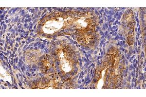 Immunohistochemistry (IHC) image for anti-Keratin 19 (KRT19) (AA 1-403) antibody (ABIN7436894)