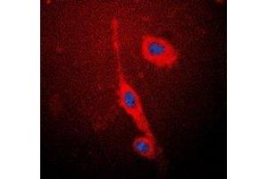 Immunofluorescent analysis of eNOS staining in MCF7 cells. (ENOS 抗体  (C-Term))