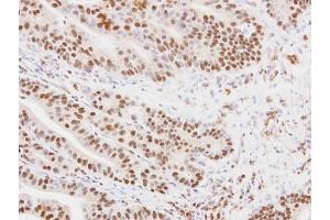 IHC-P Image Immunohistochemical analysis of paraffin-embedded PC14 xenograft, using MKRN1, antibody at 1:100 dilution. (MKRN1 抗体)