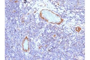 Formalin-fixed, paraffin-embedded human Tonsil stained with vWF Mouse Monoclonal Antibody (VWF/1465). (VWF 抗体  (AA 1815-1939))