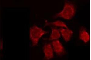 ABIN6274901 staining HepG2 by IF/ICC. (BCL2L12 抗体  (Internal Region))