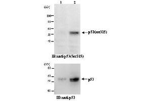 Western Blotting (WB) image for anti-Tumor Protein P53 (TP53) (pSer315) antibody (ABIN1449252) (p53 抗体  (pSer315))
