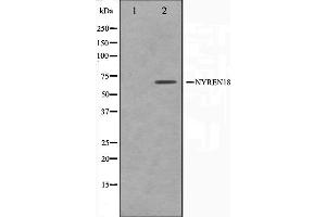 Western blot analysis on COS7 cell lysate using NYREN18 Antibody,The lane on the left is treated with the antigen-specific peptide. (NUB1 抗体)