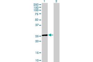 Western Blot analysis of EGLN3 expression in transfected 293T cell line by EGLN3 MaxPab polyclonal antibody. (EGLN3 抗体  (AA 1-239))