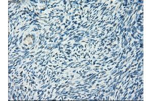 Immunohistochemical staining of paraffin-embedded colon tissue using anti-PORmouse monoclonal antibody. (POR 抗体)