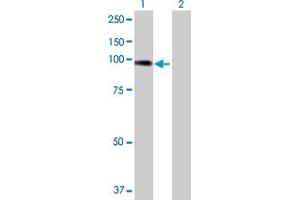 Western Blot analysis of ACTN4 expression in transfected 293T cell line by ACTN4 MaxPab polyclonal antibody.