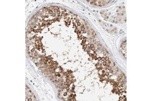 Immunohistochemical staining (Formalin-fixed paraffin-embedded sections) of human testis with CRAT polyclonal antibody  shows strong cytoplasmic positivity in cells in seminiferous ducts. (CRAT 抗体)