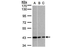 WB Image Sample (30μg whole cell lysate) A:A431, B:MOLT4 , C:Raji , 7. (G Protein alpha Inhibitor 3 (Center) 抗体)