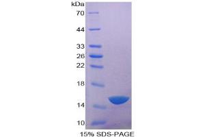 SDS-PAGE analysis of Human Acid Phosphatase 1 Protein. (ACP1 蛋白)