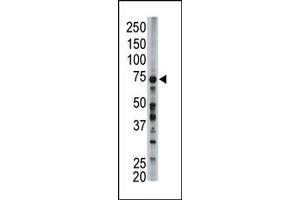 Image no. 1 for anti-Acyl-CoA Synthetase Long-Chain Family Member 6 (ACSL6) (Middle Region) antibody (ABIN357782) (ACSL6 抗体  (Middle Region))