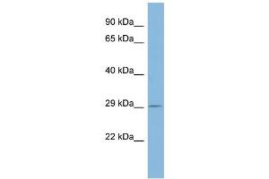 WB Suggested Anti-PSMD10 Antibody Titration: 0. (PSMD10 抗体  (Middle Region))