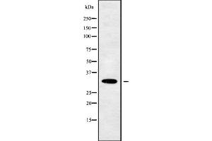 Western blot analysis OR10W1 using 293 whole cell lysates (OR10W1 抗体  (Internal Region))
