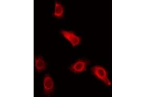 ABIN6275649 staining Hela by IF/ICC. (Ubiquilin 3 抗体  (Internal Region))