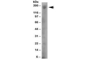 Western blot testing of human A431 lysate with DOCK1 antibody at 4ug/ml. (DOCK1 抗体)
