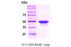 SDS-PAGE (SDS) image for Protein Phosphatase, Mg2+/Mn2+ Dependent, 1A (PPM1A) (AA 1-382) (Active) protein (His tag) (ABIN666675)