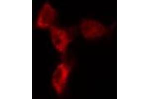 ABIN6274621 staining 293T by IF/ICC. (COL1A2 抗体  (N-Term))