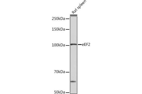 EEF2 anticorps