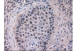 Immunohistochemical staining of paraffin-embedded kidney using anti-KRT18 (ABIN2452674) mouse monoclonal antibody. (Cytokeratin 18 抗体  (AA 69-372))
