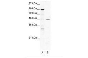 Image no. 1 for anti-Nuclear Receptor Subfamily 2, Group F, Member 6 (NR2F6) (AA 264-313) antibody (ABIN202436) (NR2F6 抗体  (AA 264-313))