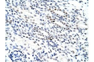 NOL4 antibody was used for immunohistochemistry at a concentration of 4-8 ug/ml to stain Epithelial cells of renal tubule (arrows) in Human Kidney. (NOL4 抗体  (N-Term))