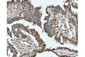 IHC analysis of MAT2A using anti-MAT2A antibody (ABIN7599120).