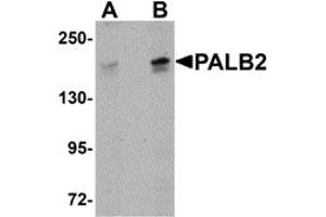 Western Blotting (WB) image for anti-Partner and Localizer of BRCA2 (PALB2) (C-Term) antibody (ABIN1030568) (PALB2 抗体  (C-Term))