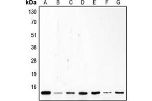 Western blot analysis of p14 ARF expression in Saos2 (A), Molt (B), K562 (C), Jurkat (D), HL60 (E), MCF7 (F), HeLa (G) whole cell lysates. (CDKN2A 抗体  (Center))