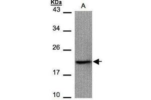 WB Image Sample(30 μg of whole cell lysate) A:293T 15% SDS PAGE antibody diluted at 1:1000 (Survivin 抗体)