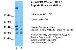 Host:  Rabbit  Target Name:  ZEB2  Sample Type:  Jurkat Whole Cell  Lane A:  Primary Antibody  Lane B:  Primary Antibody + Blocking Peptide  Primary Antibody Concentration:  1ug/ml  Peptide Concentration:  5ug/ml  Lysate Quantity:  25ug/lane/Lane  Gel Concentration:  0. (ZEB2 抗体  (N-Term))