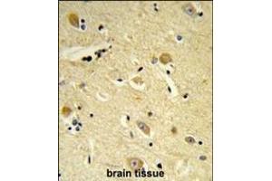 Formalin-fixed and paraffin-embedded human brain tissue reacted with CDIPT Antibody (Center), which was peroxidase-conjugated to the secondary antibody, followed by DAB staining. (CDIPT 抗体  (AA 99-125))