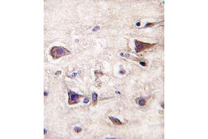 Formalin-fixed and paraffin-embedded human brain tissue reacted with PDGFA antibody (N-term), which was peroxidase-conjugated to the secondary antibody, followed by DAB staining. (PDGFA 抗体  (N-Term))