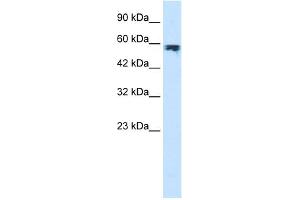 WB Suggested Anti-ZYX Antibody Titration:  1. (ZYX 抗体  (Middle Region))
