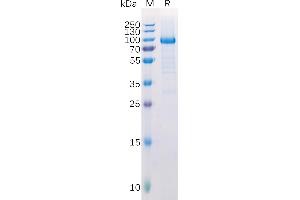 SDS-PAGE (SDS) image for Lymphocyte-Activation Gene 3 (LAG3) (AA 23-245) protein (Fc Tag) (ABIN6964106)