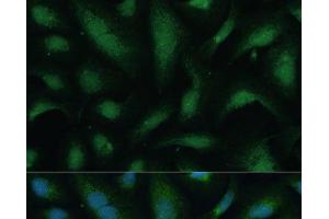Immunofluorescence (IF) image for anti-Kinesin Family Member 14 (KIF14) antibody (ABIN7255237)
