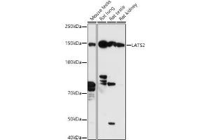 Western blot analysis of extracts of various cell lines, using L antibody (ABIN7268192) at 1:500 dilution. (LATS2 抗体  (AA 1-100))